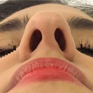 clínica estética en valencia