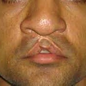 clínica estética en valencia