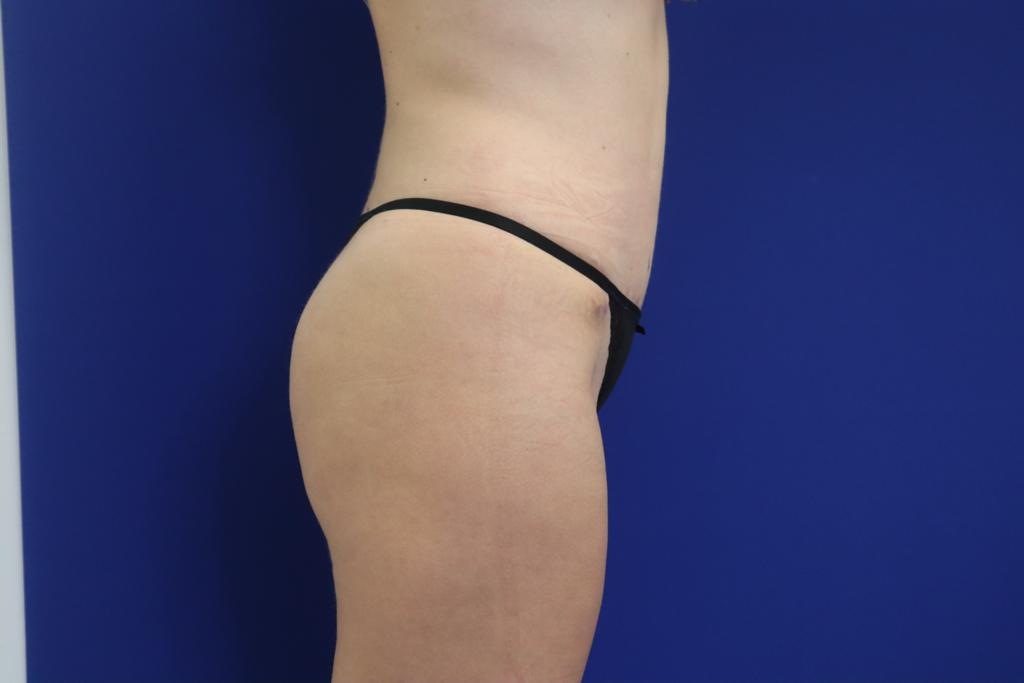 clínica estética en valencia clínica estética en valencia