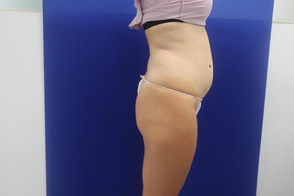clínica estética en valencia clínica estética en valencia