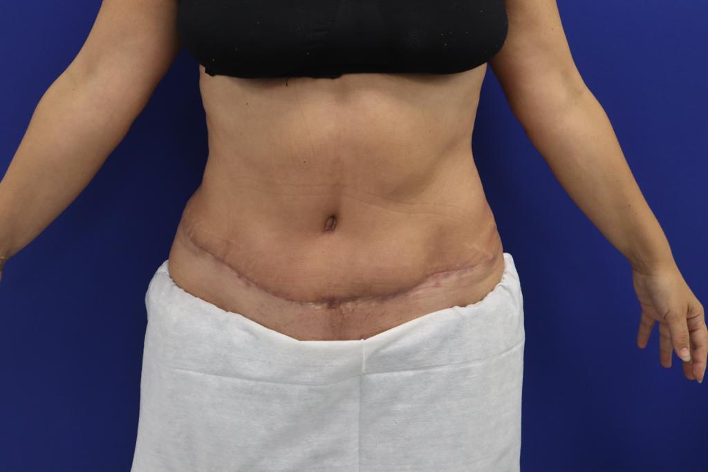 clínica estética en valencia clínica estética en valencia