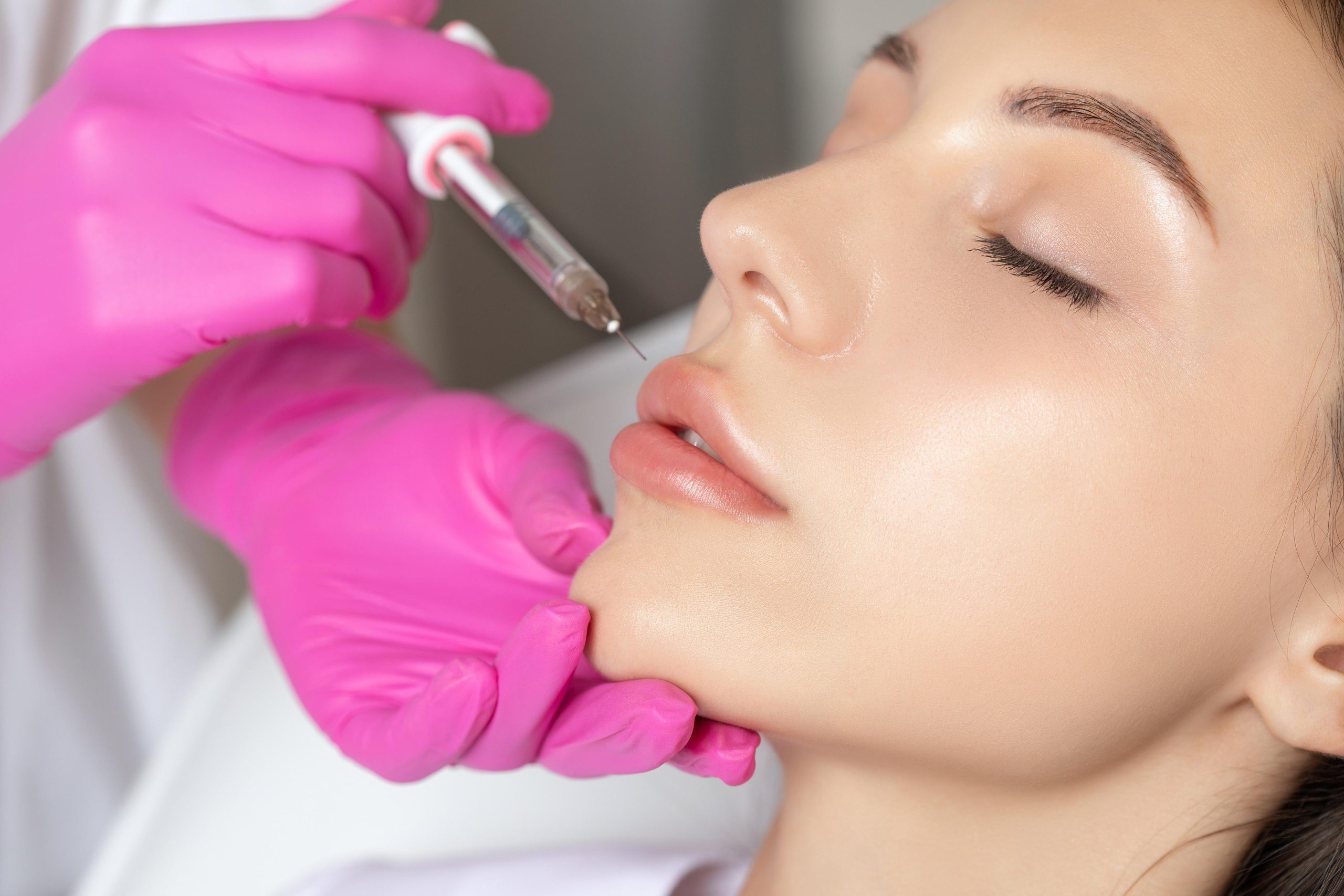 aumento de labios en Valencia