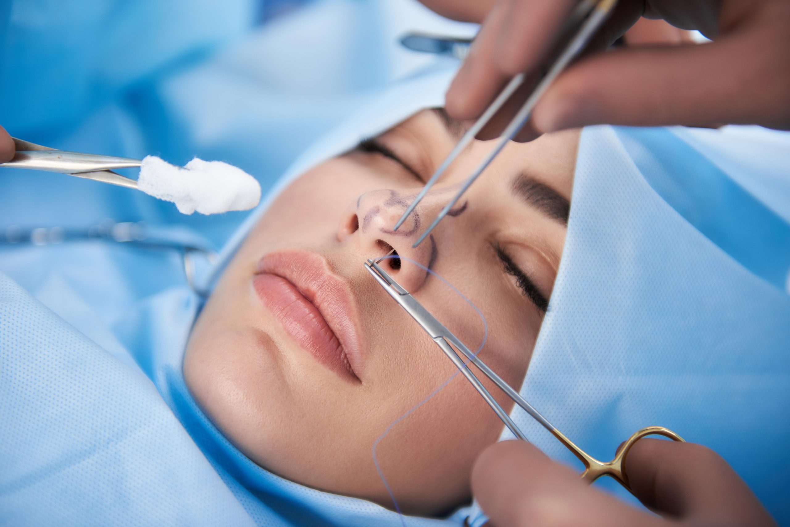 rinoplastia en Valencia